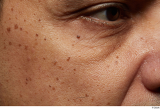 HD Face Skin Cristian Andrade cheek eye face skin texture…